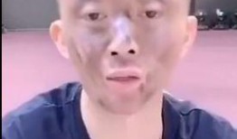 庆哥庆嫂吃瓜视频大全,揭秘娱乐圈幕后趣闻