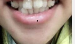 台湾牙套妹吃瓜视频,揭秘网红幕后生活