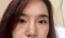 吃瓜抠鼻子教程视频大全,吃瓜抠鼻子教程视频大全汇总