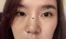 吃瓜抠鼻子教程视频大全,吃瓜抠鼻子教程视频大全汇总